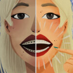 Graphic illustration of woman smiling comparing Invisalign clear aligners vs traditional braces